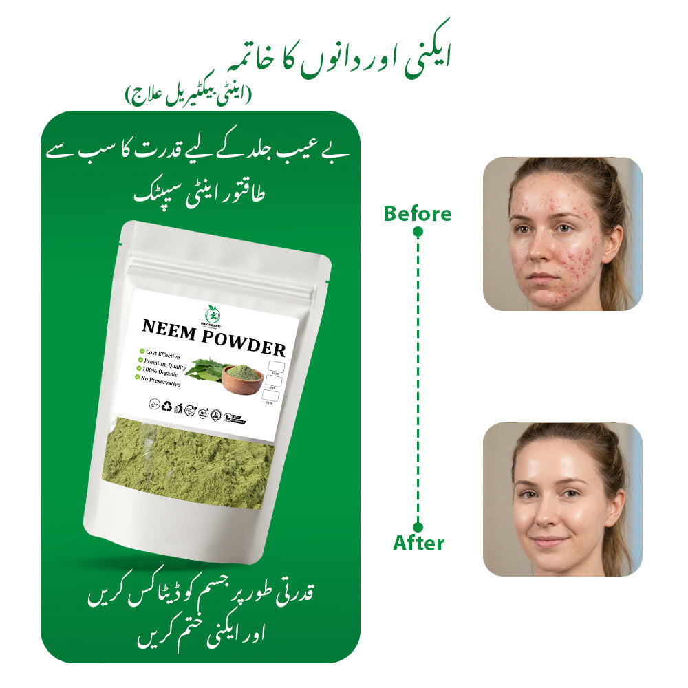FACE ACNE KIT